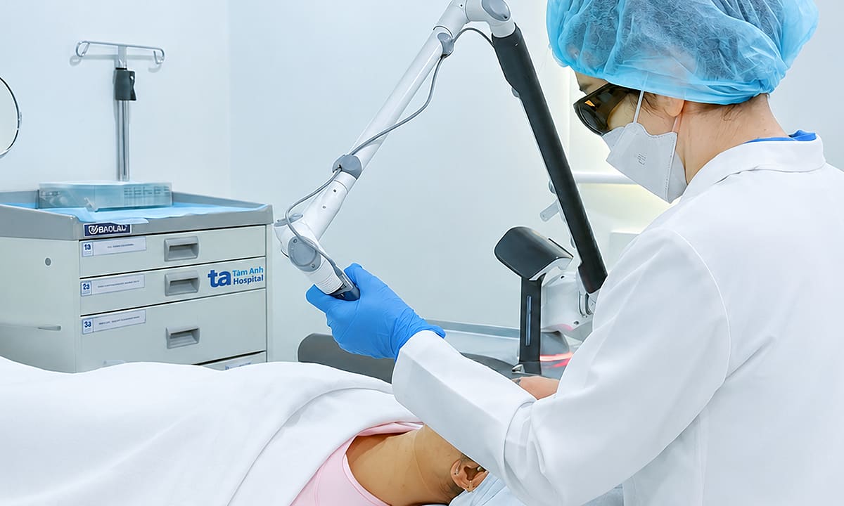 Điều trị nám bằng laser
