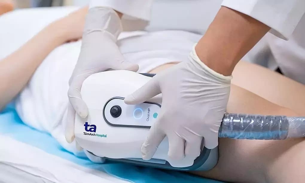 Công nghệ đông hủy mỡ có dùng được ở bắp tay?