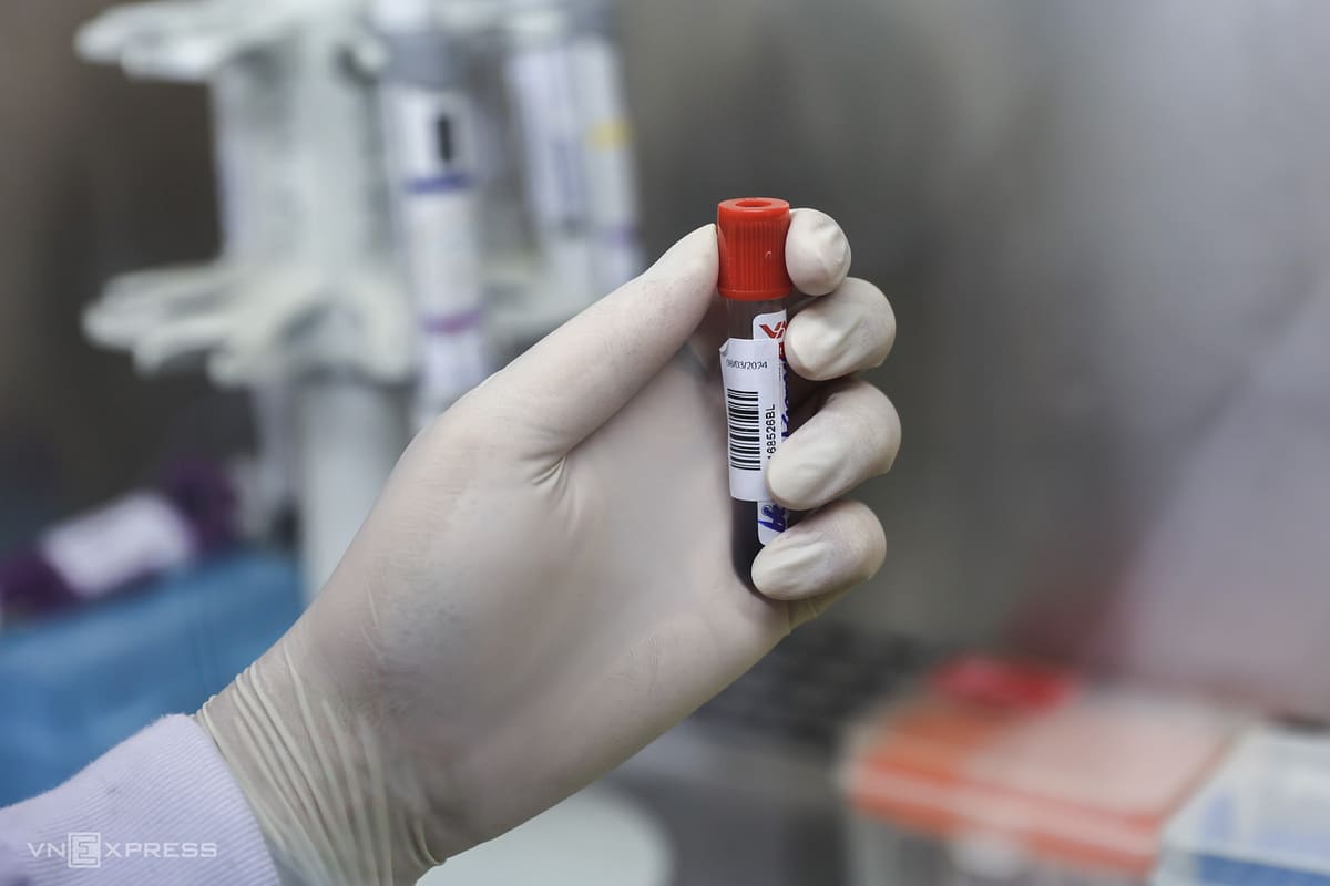 28 học sinh ngộ độc do nhiễm khuẩn Salmonella từ món trứng cuộn