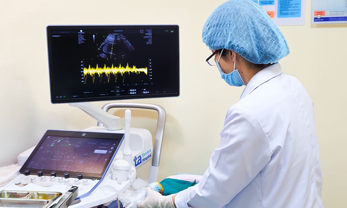 Sinh thiết gai nhau phát hiện thai nhi bất thường nhiễm sắc thể