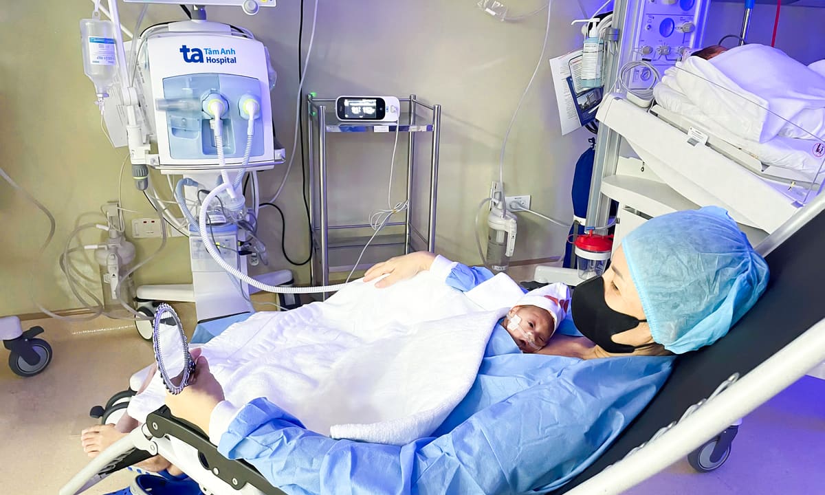 Khi nào trẻ sinh non có thể được da kề da với mẹ?