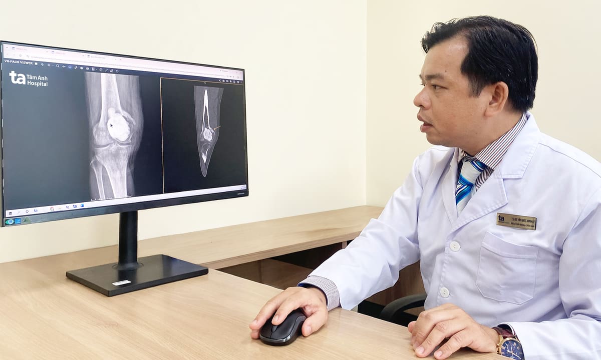 U phá hủy xương khớp gối người đàn ông