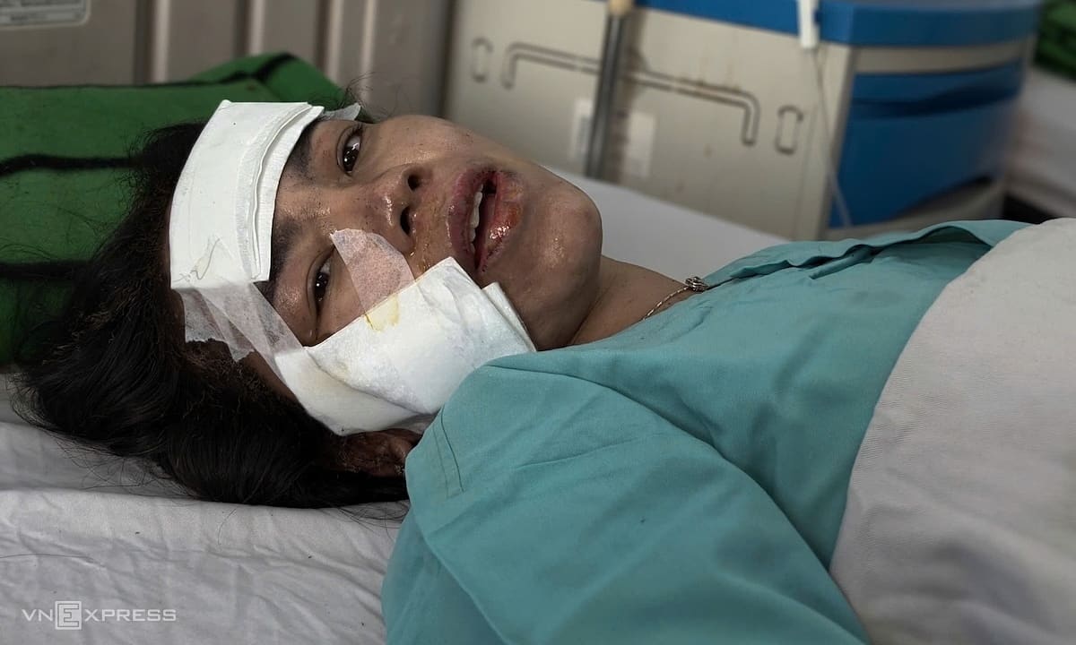 Побег всадника в постели был в огне
