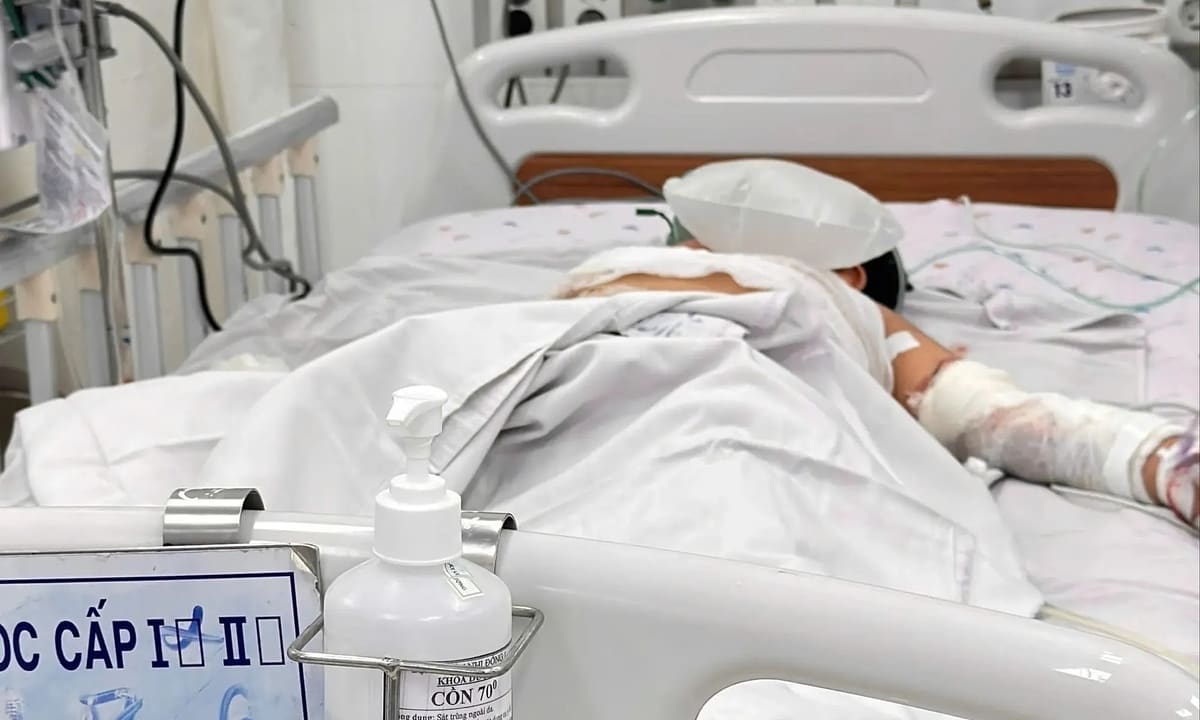 Мальчик сжег 50% тела после того, как родители спасли его из горящего автобуса
