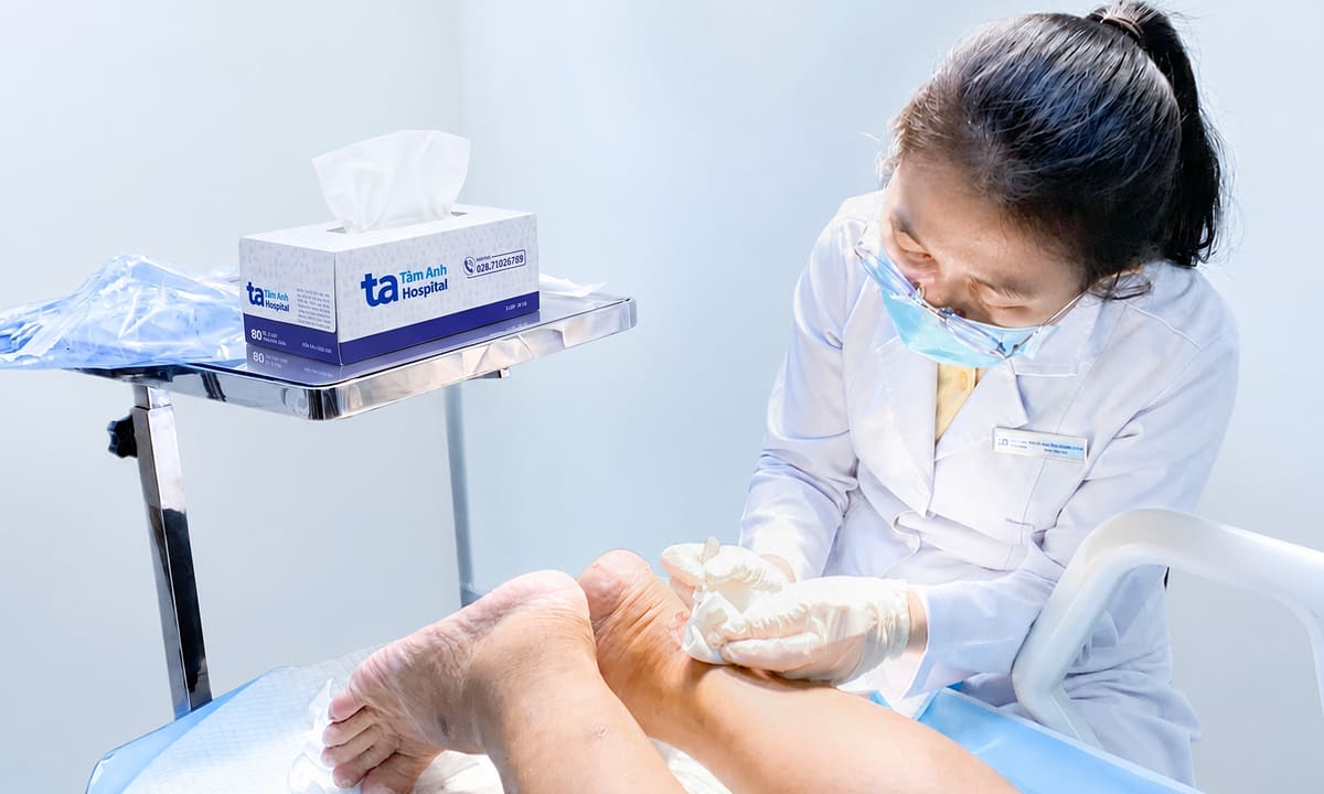 Viêm gân bàn chân do tiểu đường