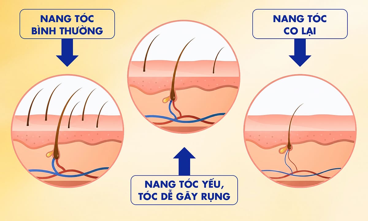 Nhuộm tóc có khiến tóc rụng nhiều hơn?