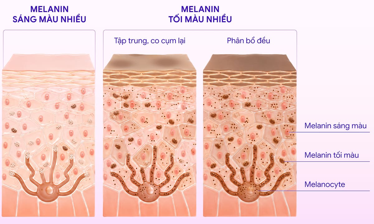 Nám da hình thành như thế nào