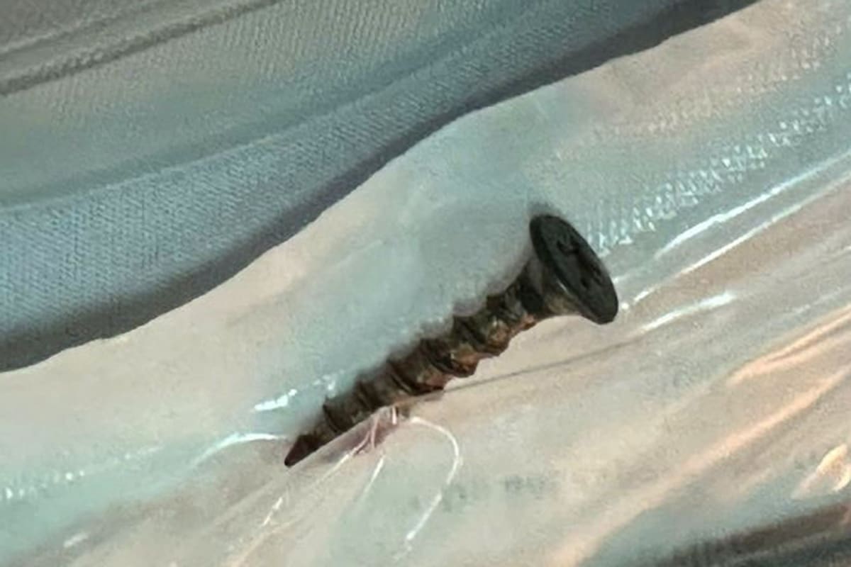 Chiếc đinh vít dài 4 cm trong đường thở bé trai